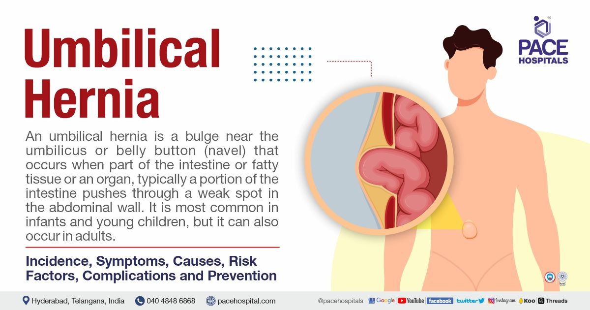 Umbilical hernia Symptoms, Causes, Incidence, Risk Factors, Complications and Prevention