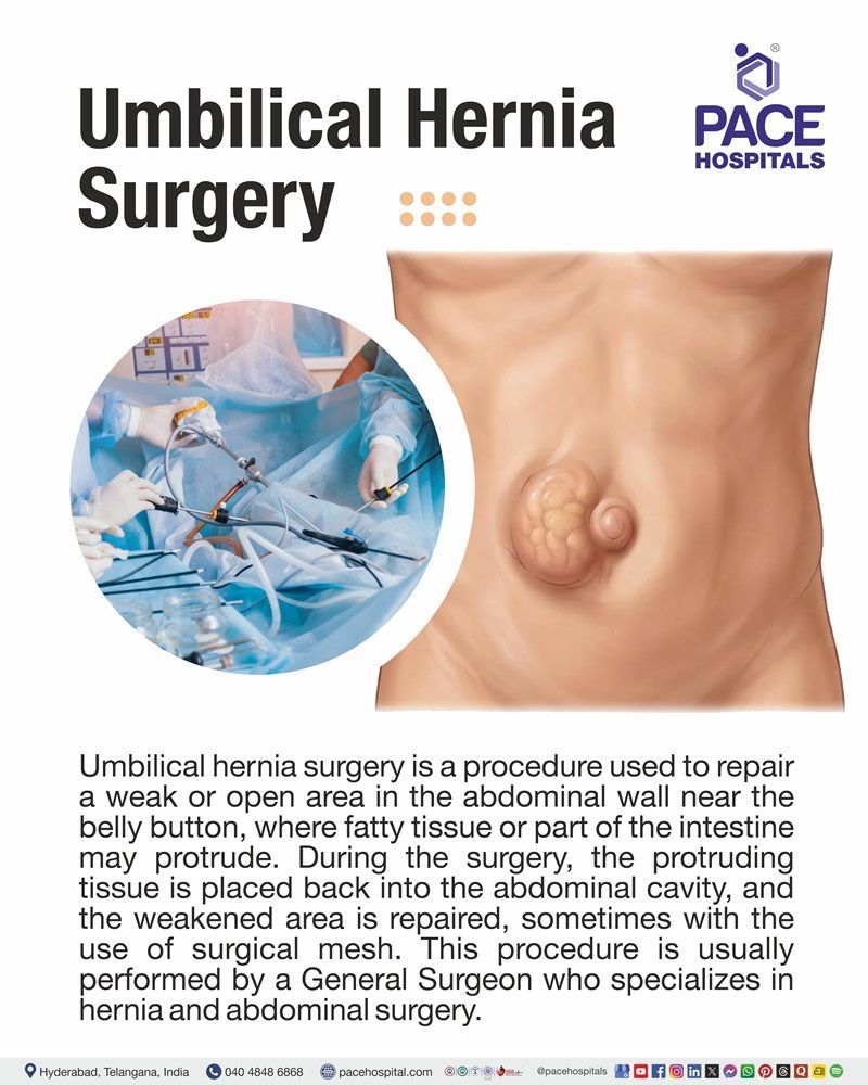 Umbilical Hernia Surgery Overview Visual depicting Umbilical hernia surgery overview using open and laparoscopic repair