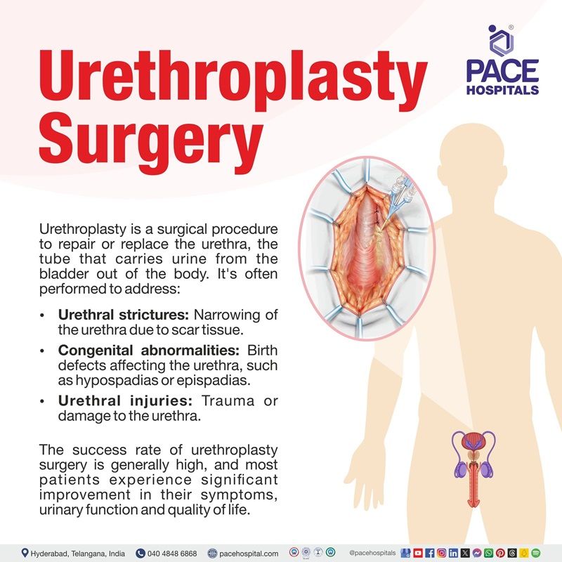 What is urethroplasty surgery / procedure urethroplasty surgery meaning | urethroplasty surgery cost in India | buccal mucosal graft urethroplasty in Hyderabad | urethroplasty surgery cost in Hyderabad