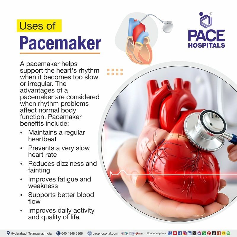 Uses of Pacemaker Visual depicting the Uses of Pacemaker and how it is beneficial to the heart