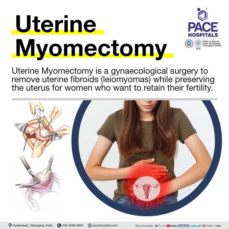 Uterine Myomectomy surgery in Hyderabad Uterine Myomectomy surgery | Myomectomy Procedure | Myomectomy surgery in Hyderabad | Myomectomy Surgery Cost