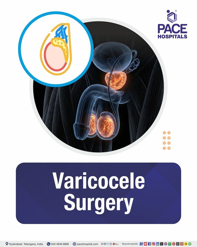 Varicocele Surgery Cost in Hyderabad | Affordable Varicocele Surgery Cost in India