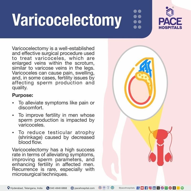 Varicocelectomy Surgery Varicocelectomy definition | varicocelectomy surgery cost in Hyderabad | best hospital for varicocelectomy surgery in Hyderabad | surgery for varicoceles in Hyderabad, India