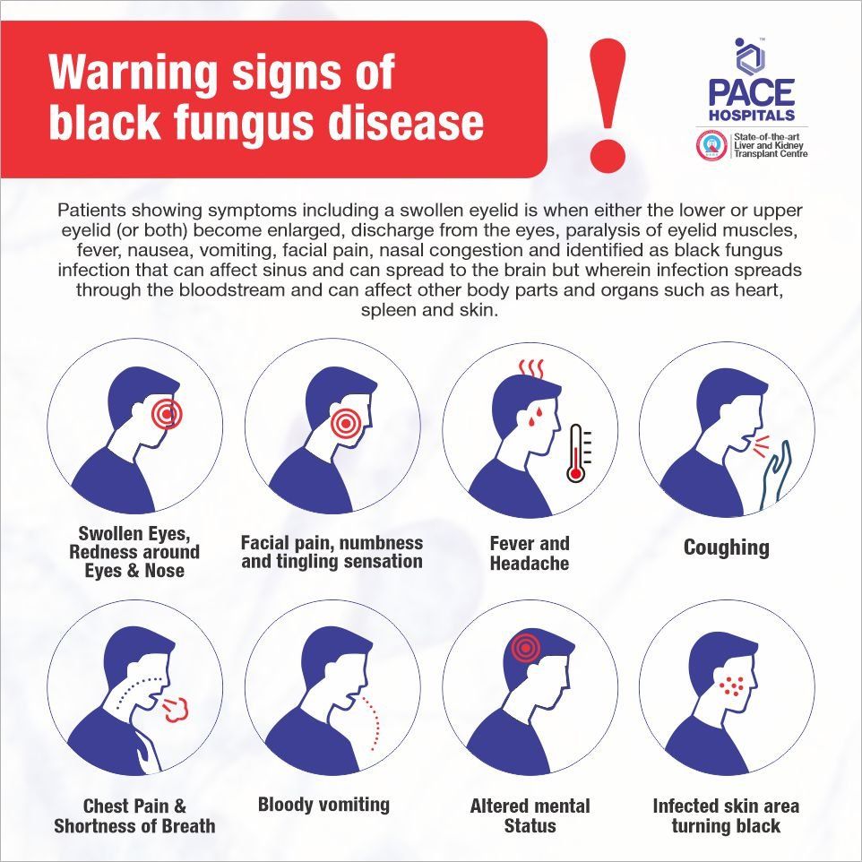 Mucormycosis: Black fungus disease symptoms and warning signs - Pace Hospitals Mucormycosis: Black fungus disease symptoms and warning signs - Pace Hospitals