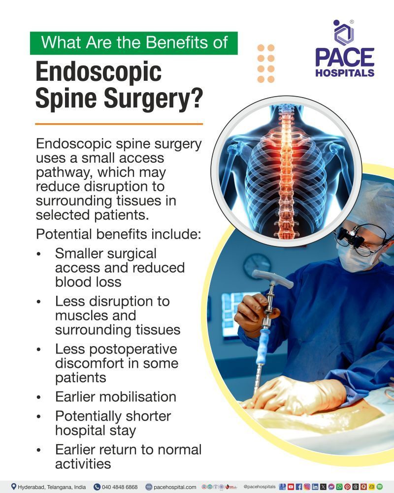 Benefits of Endoscopic Spine Surgery Endoscopic Spine Surgery Benefits | Advantages of Endoscopic Spine Surgery