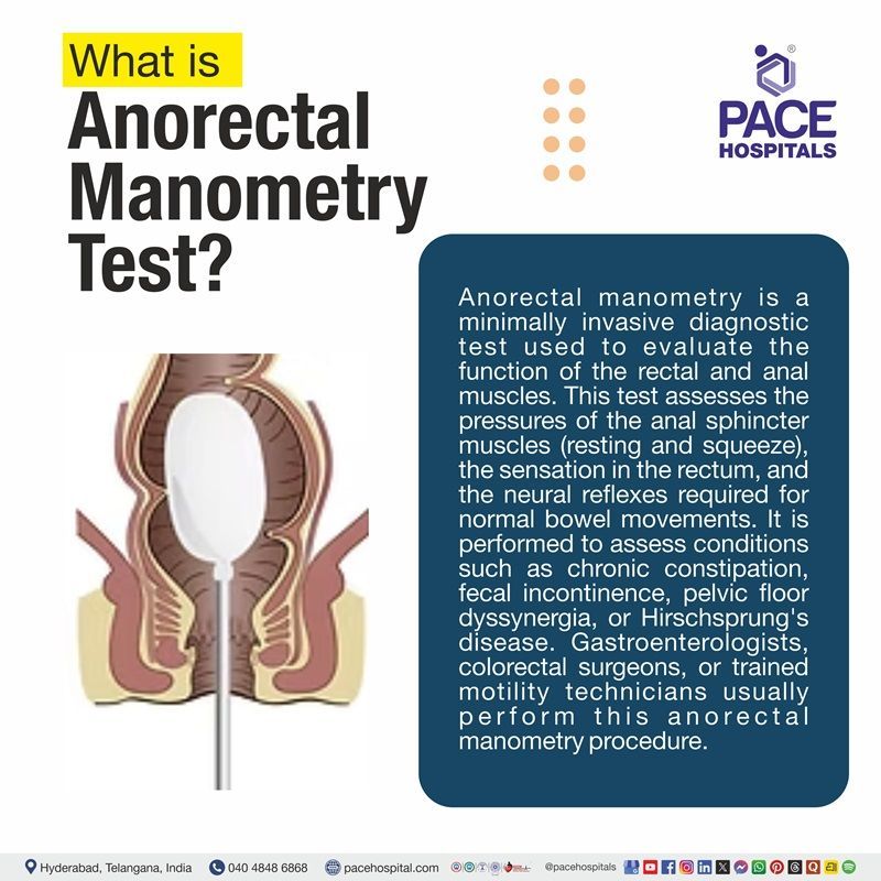 What is Anorectal Manometry Test? What is Anorectal Manometry Test? | anorectal manometry procedure | Anal Manometry