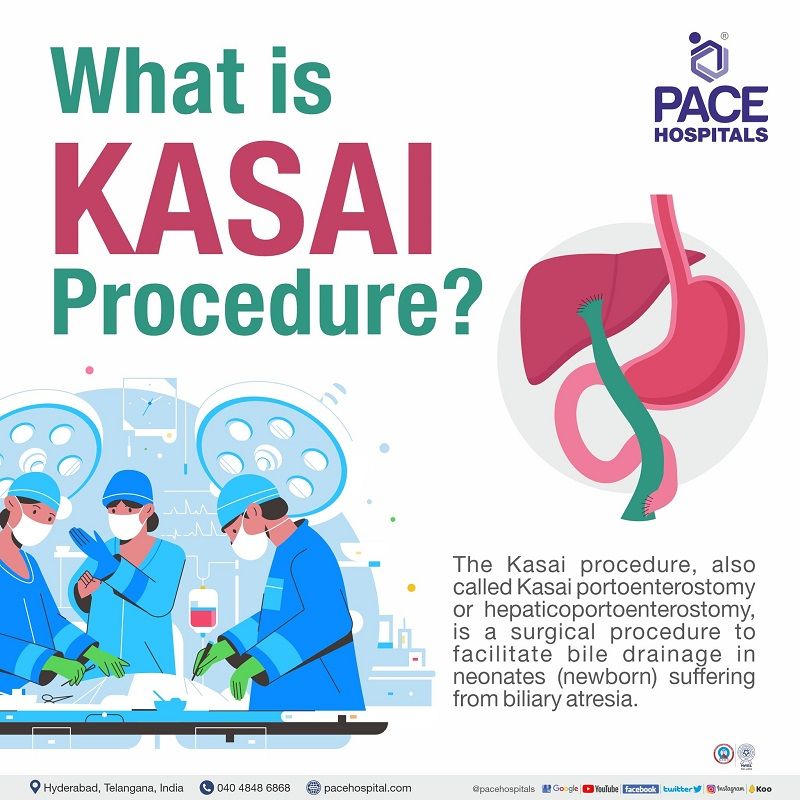 What is Kasai procedure or surgery? What is kasai procedure | biliary atresia kasai procedure in Hyderabad Telangana India | kasai procedure indications | kasai procedure done for biliary atresia