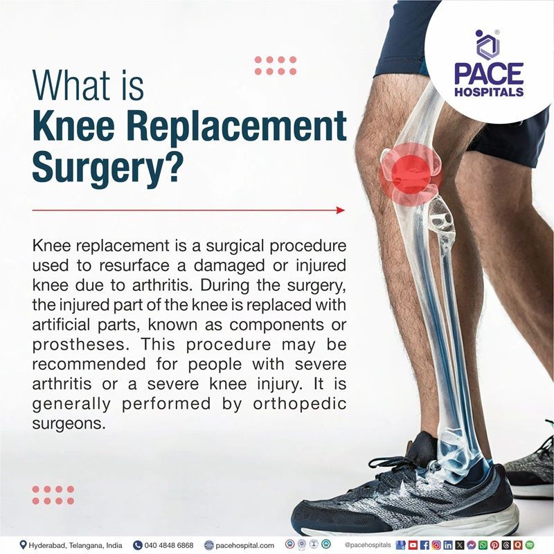 What is Knee Replacement Surgery? What is knee replacement surgery | Knee Arthroplasty | Knee joint replacement surgery