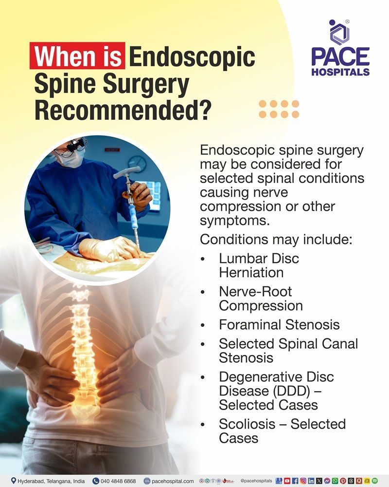 When is Endoscopic Spine Surgery Recommended ? Endoscopic Spine Surgery Recommendations | Indications of Endoscopic Spine Surgery