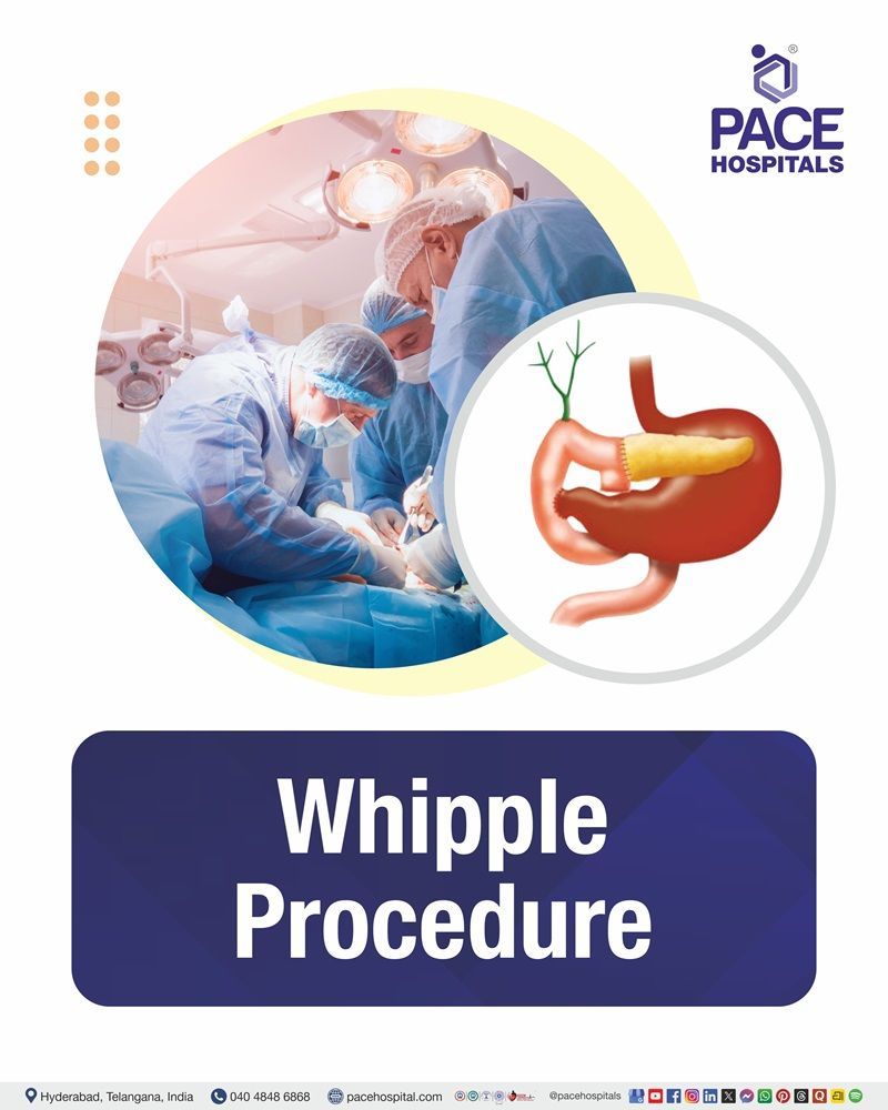 Whipple Procedure Cost in Hyderabad | Affordable Whipple Surgery in India