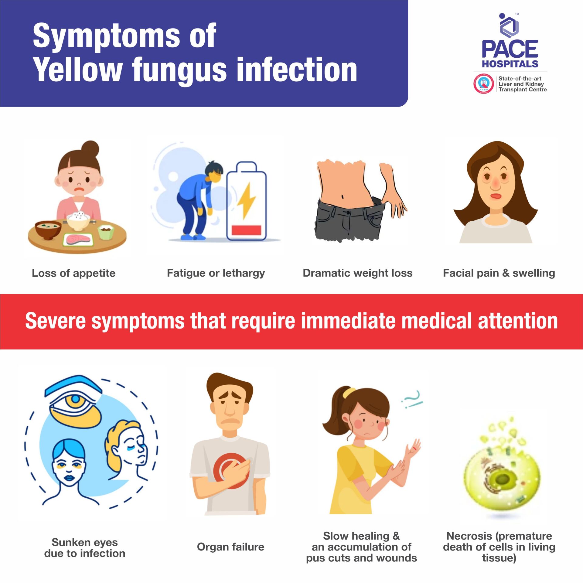 Yellow fungus symptoms - warning emergency signs of the infection Yellow fungus symptoms - warning emergency signs of the infection
