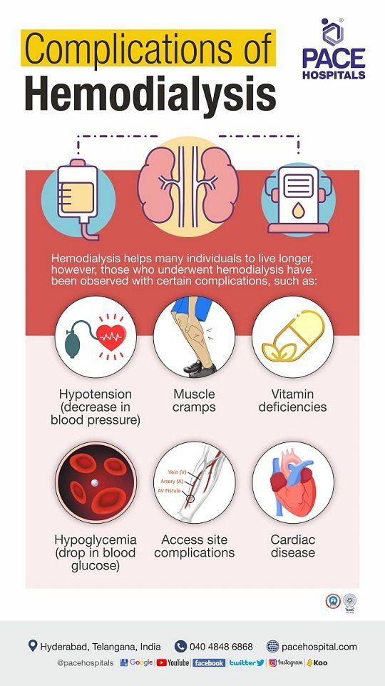 complications in hemodialysis patients | acute complications of hemodialysis
