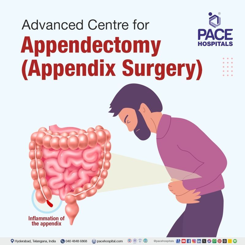 Advanced centre for appendectomy surgery in Hyderabad, India best hospital for appendix surgery in Hyderabad | appendix surgery cost in Hyderabad India | appendectomy procedure in Hyderabad | laparoscopic appendectomy cost in Hyderabad | appendectomy near me
