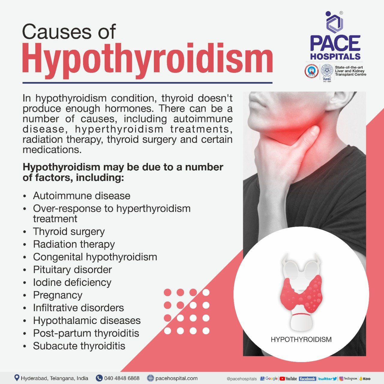 Hypothyroidism Causes Causes of Hypothyroidism