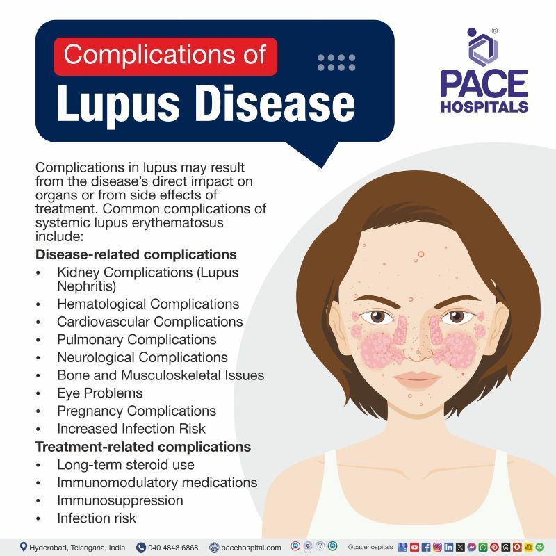 Complications of Lupus Disease Complications of systemic lupus erythematosus | Lupus complications
