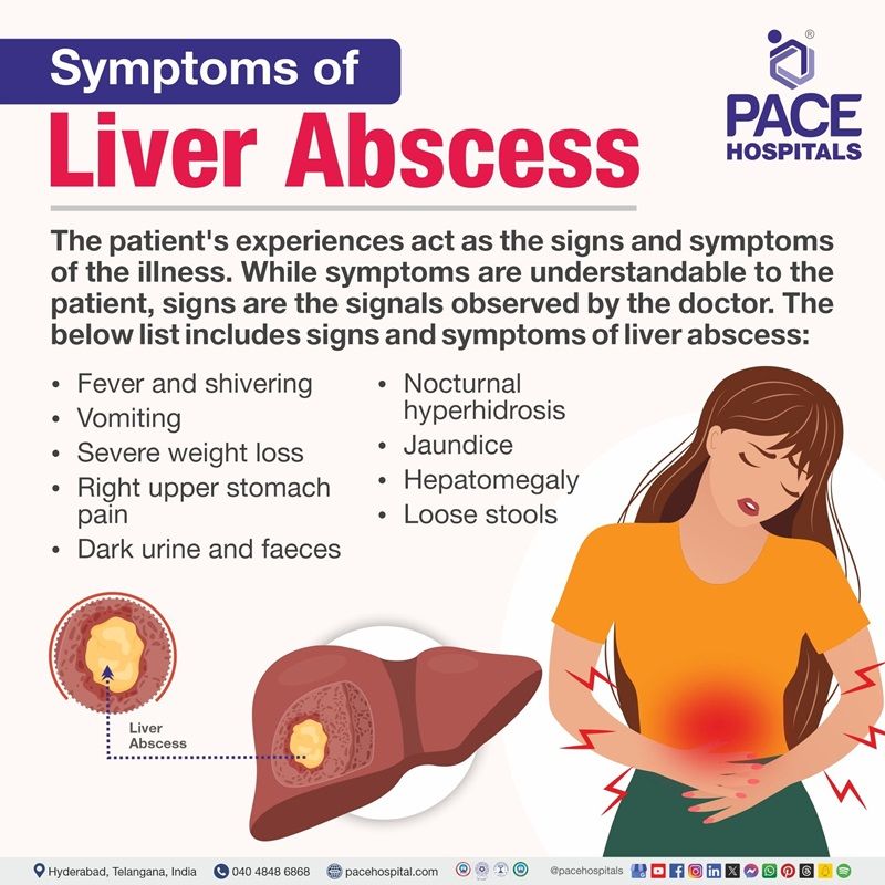 Liver abscess symptoms liver abscess symptoms | symptoms of liver abscess | amoebic liver abscess symptoms | liver abscess signs and symptoms | Visual depicting the signs and symptoms of liver abscess