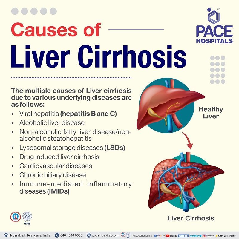 liver cirrhosis causes liver cirrhosis causes in India | etiology of liver cirrhosis | liver cirrhosis reason | what causes cirrhosis of the liver