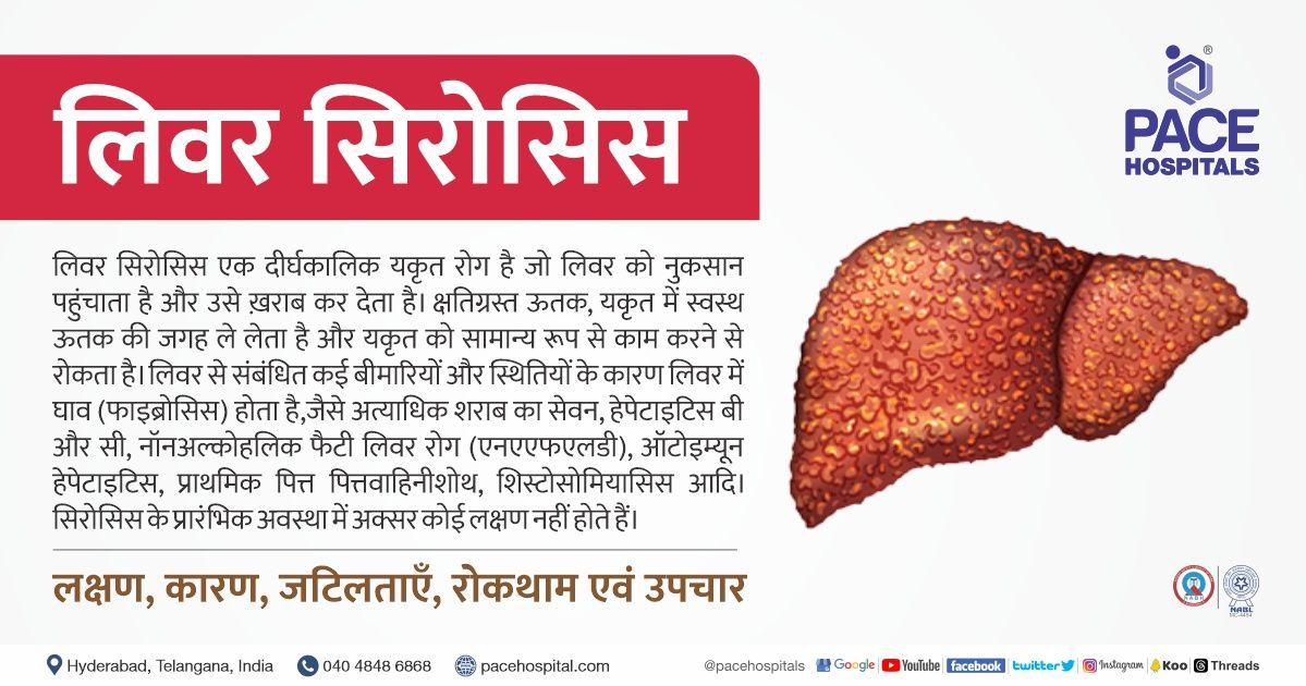 लिवर सिरोसिस - लक्षण, कारण, जटिलताएँ, रोकथाम एवं उपचार