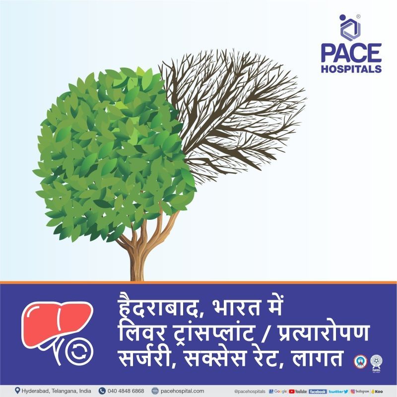 Advanced Centre for Liver Transplant in Hyderabad, Telangana, India liver transplant in hindi | Best liver transplant hospital in India | liver transplant cost in india in hindi