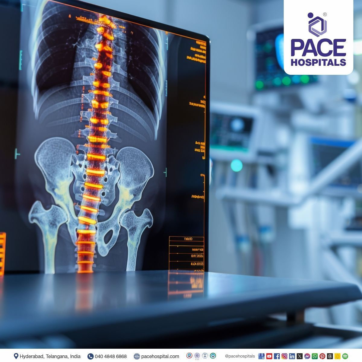 Diagnostic Tests and Procedures for all Orthopedic Diseases and Disorders Orthopaedic diagnosis in Hyderabad | shoulder orthopedic tests | orthopedic examination | knee orthopedic tests | orthopedic surgery | orthopedic procedure in India