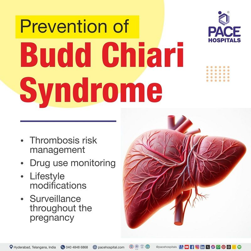 Budd-Chiari syndrome preventive measures Budd-Chiari syndrome preventive measures | Prevention of Budd Chiari syndrome | Preventive measures of Budd-Chiari syndrome | Visual outlining preventive measures of Budd-Chiari syndrome