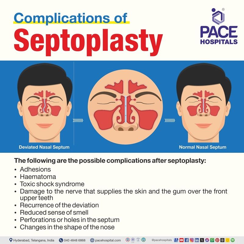 septoplasty complications | complications after septoplasty | complications of septoplasty surgery