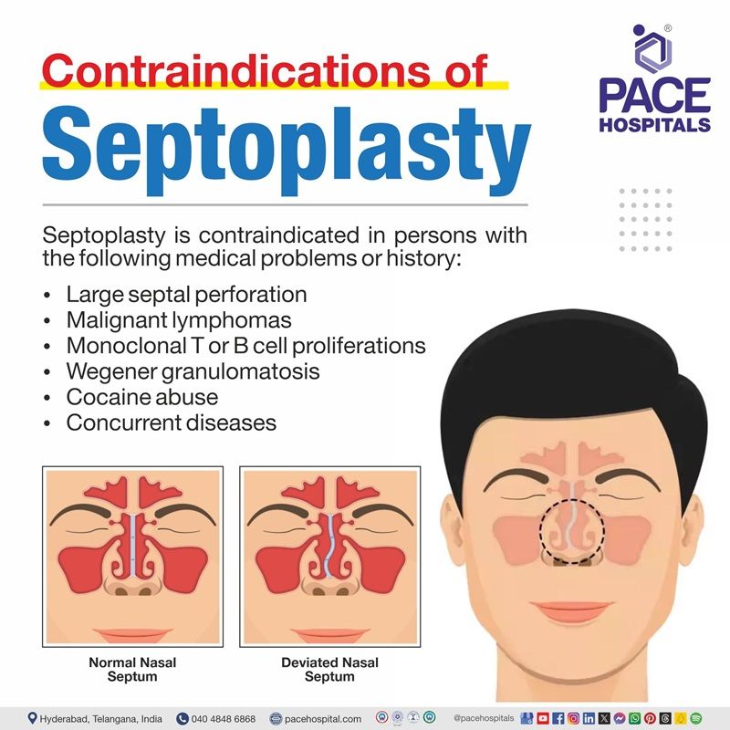 Contraindications of septolpasty | Visual depicting septoplasty contraindications