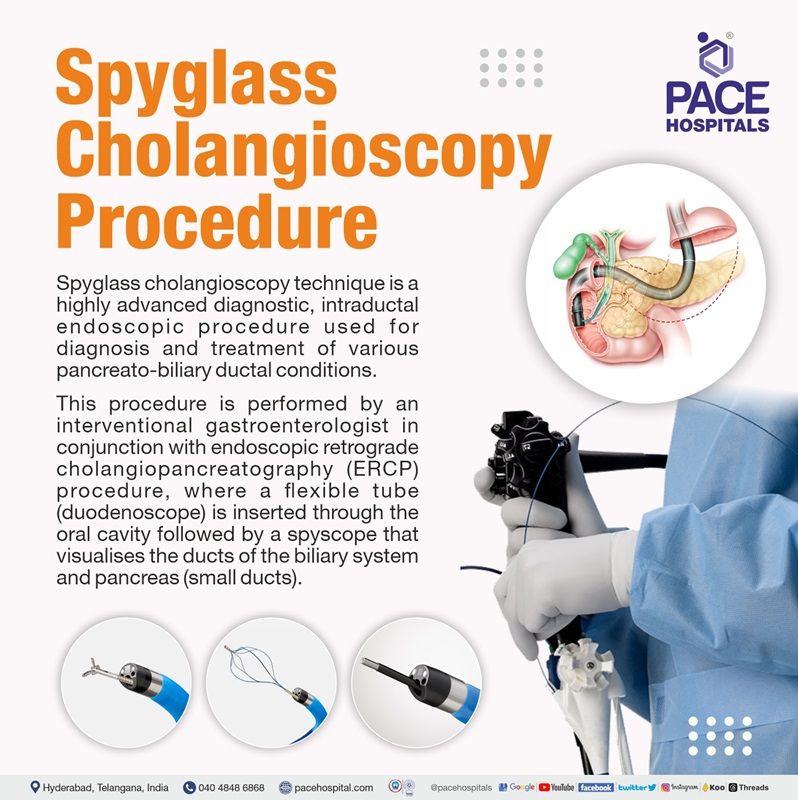 spyglass cholangioscopy technique what is spyglass cholangioscopy technique | Best Hospital for Spyglass Cholangioscopy Procedure in Hyderabad, India | ERCP Spyglass Cholangioscopy near me