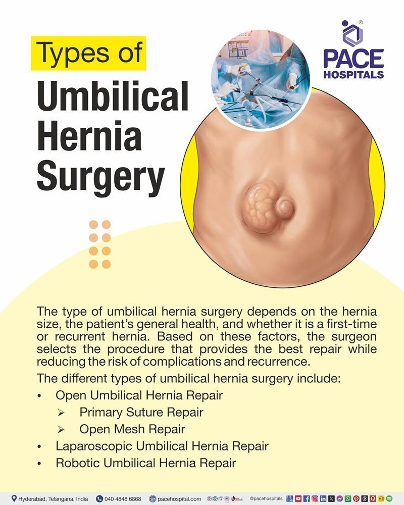 Umbilical Hernia Surgery Types Types of umbilical hernia surgery including open, laparoscopic and robotic repair | Different approaches of Umbilical hernia surgery