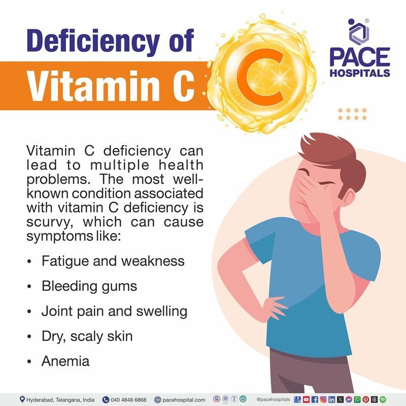 Deficiency of vitamin c vitamin c deficiency | vitamin c deficiency symptoms | deficiency of vitamin c causes | vitamin c deficiency leads to