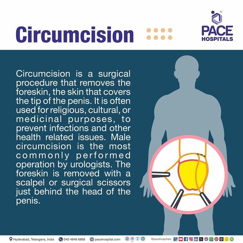 What is Circumcision Surgery best circumcision hospitals in Hyderabad | circumcision cost in Hyderabad | painless male circumcision Hyderabad | circumcision laser surgery cost in Hyderabad India