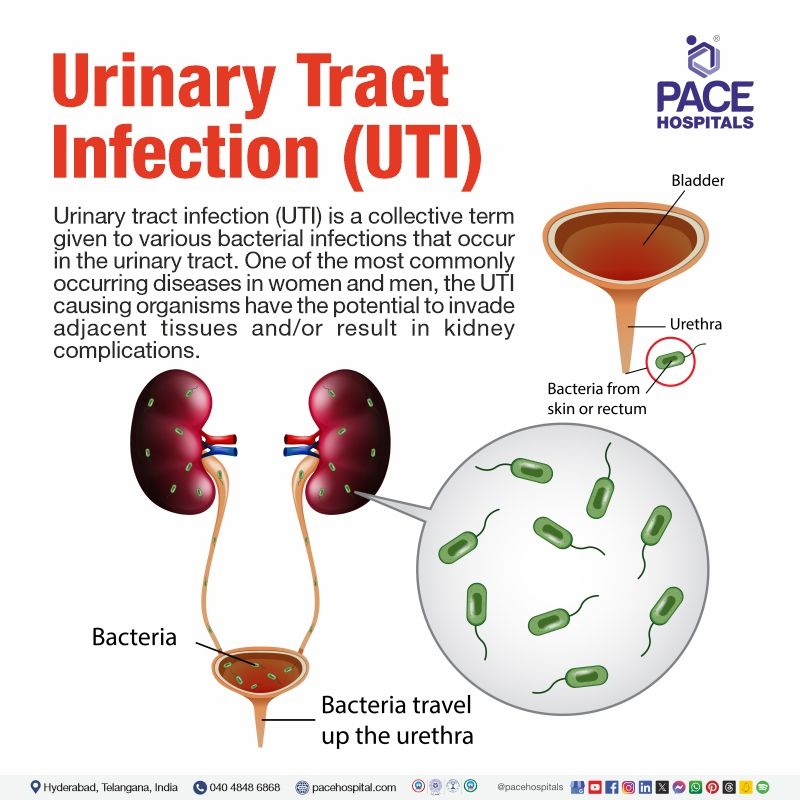 What is urinary tract infection (UTIs) urinary tract infection definition | urinary tract infections utis | complex UTIs | uncomplicated UTIs in women and men