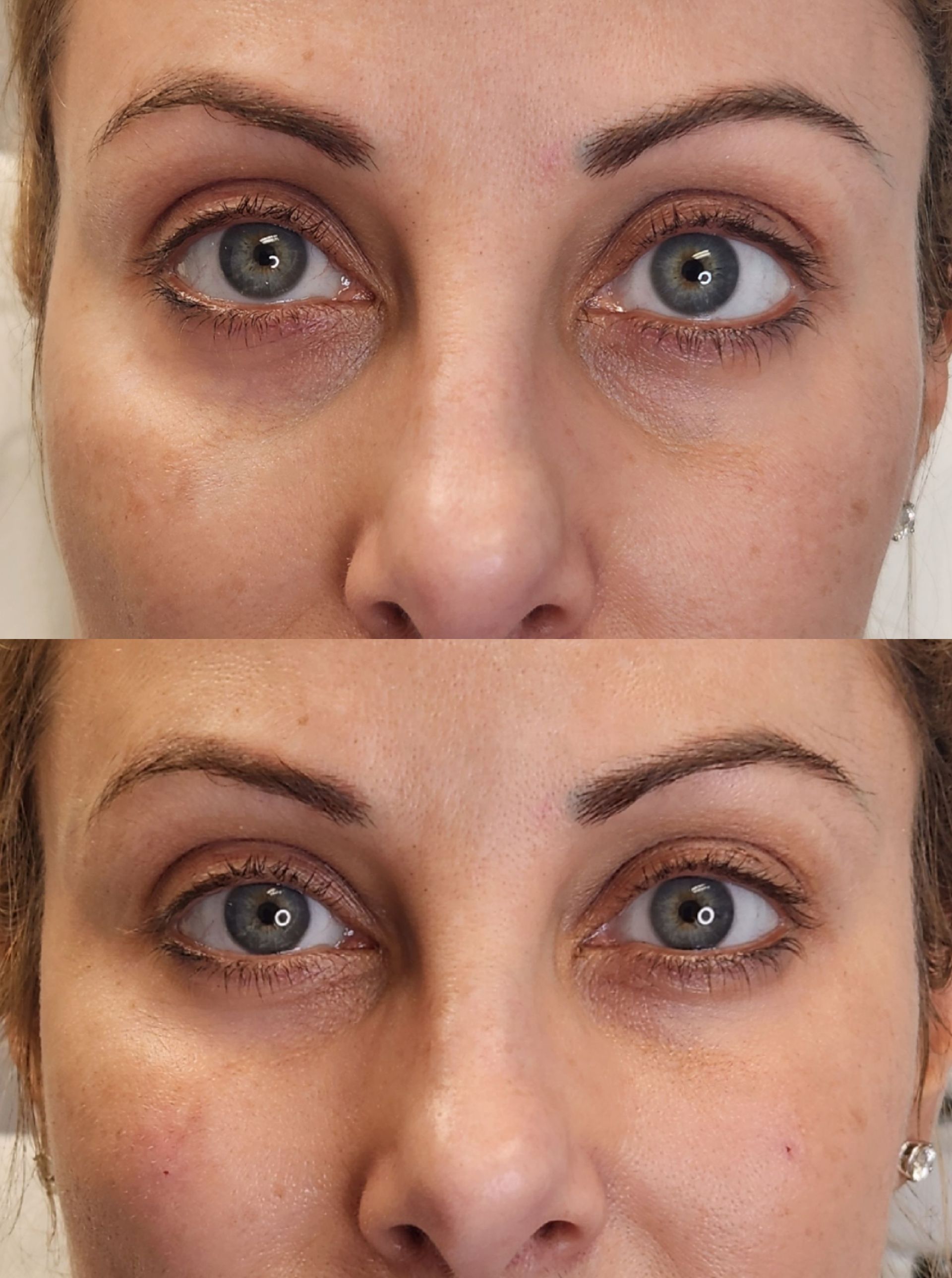 A before and after photo of a woman 's eyes.