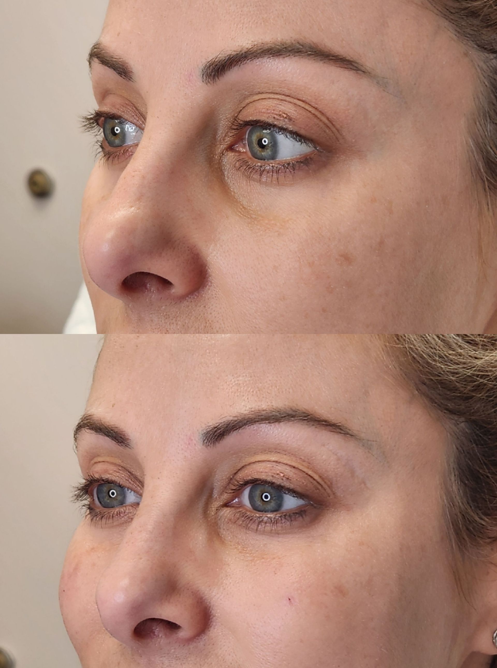A before and after photo of a woman 's face.