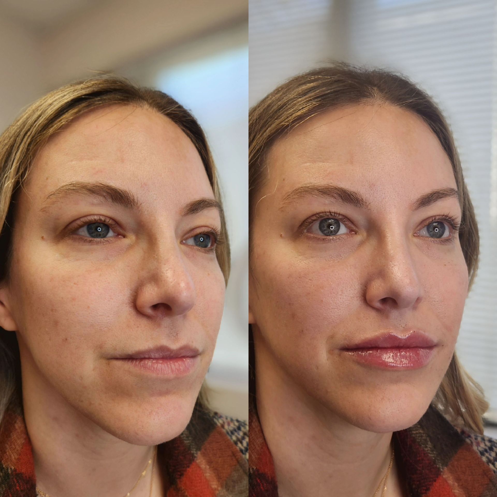 A before and after photo of a woman 's face.