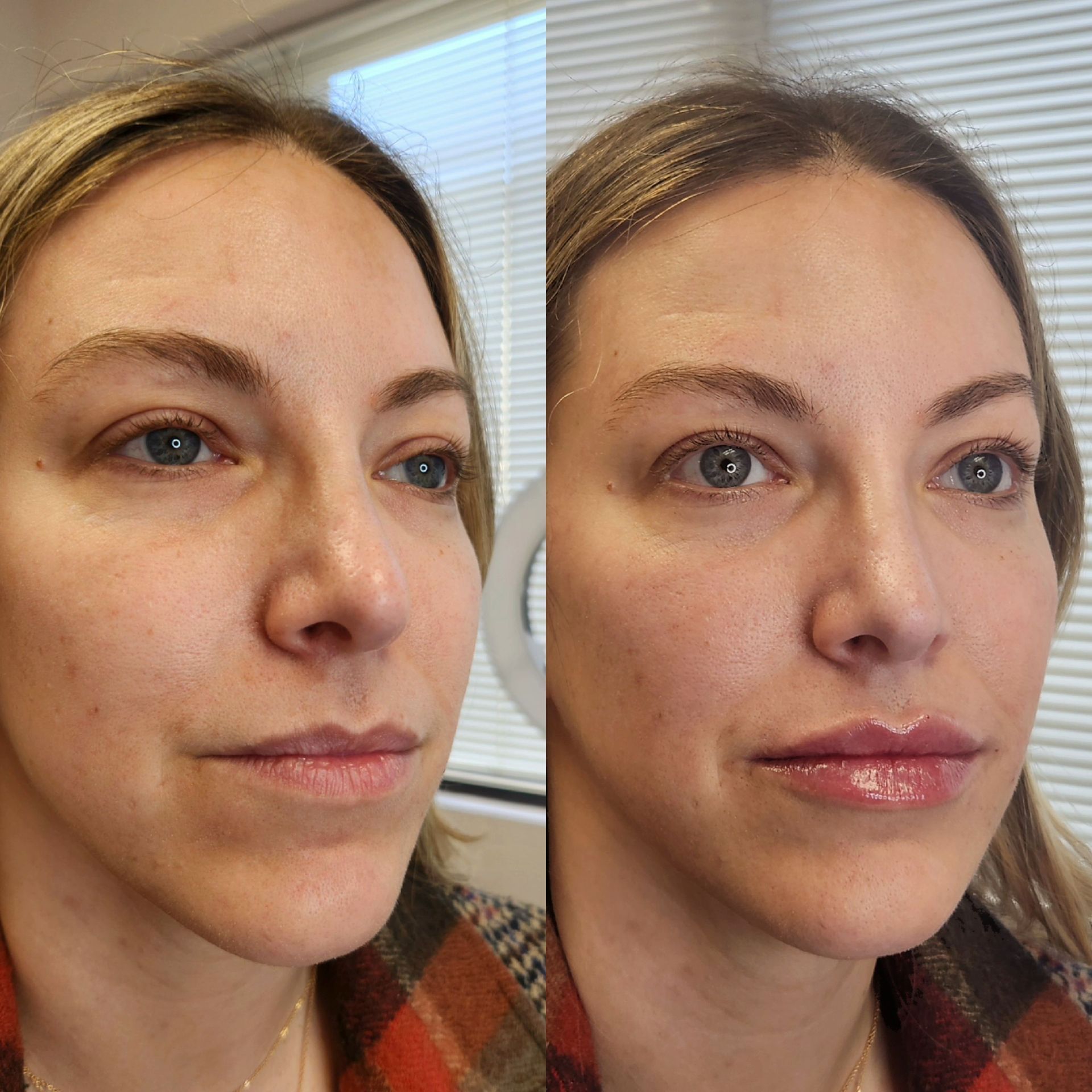 A before and after photo of a woman 's face.