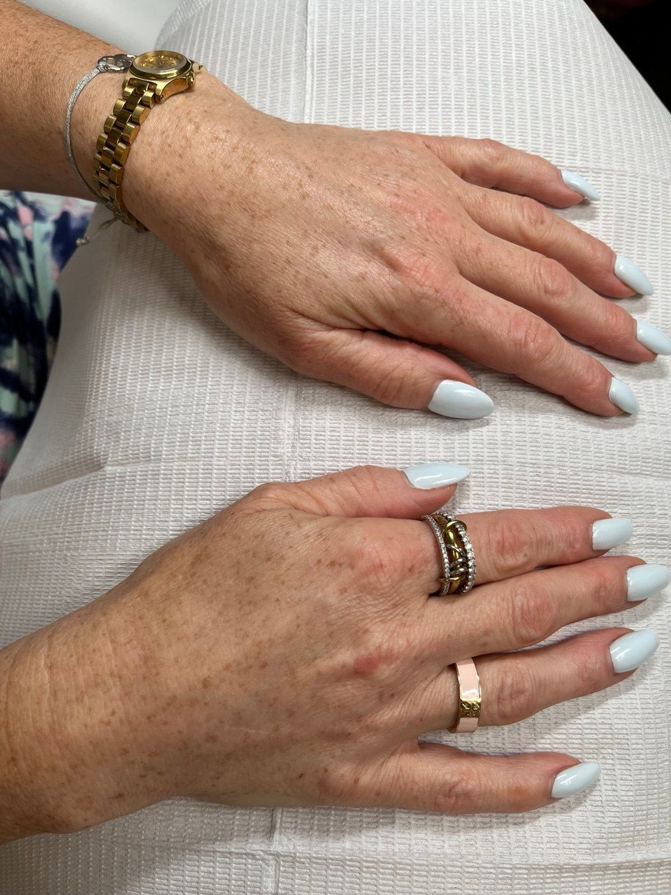 Two hands with light blue painted nails, adorned with rings and a watch, resting on a white surface.