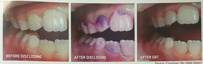 Pedodontics | Brisbane, QLD | Carina Dental Practice Pedodontics | Brisbane, QLD | Carina Dental Practice