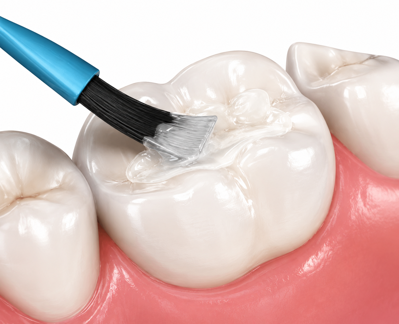 Dental brush cleaning a molar tooth with toothpaste foam