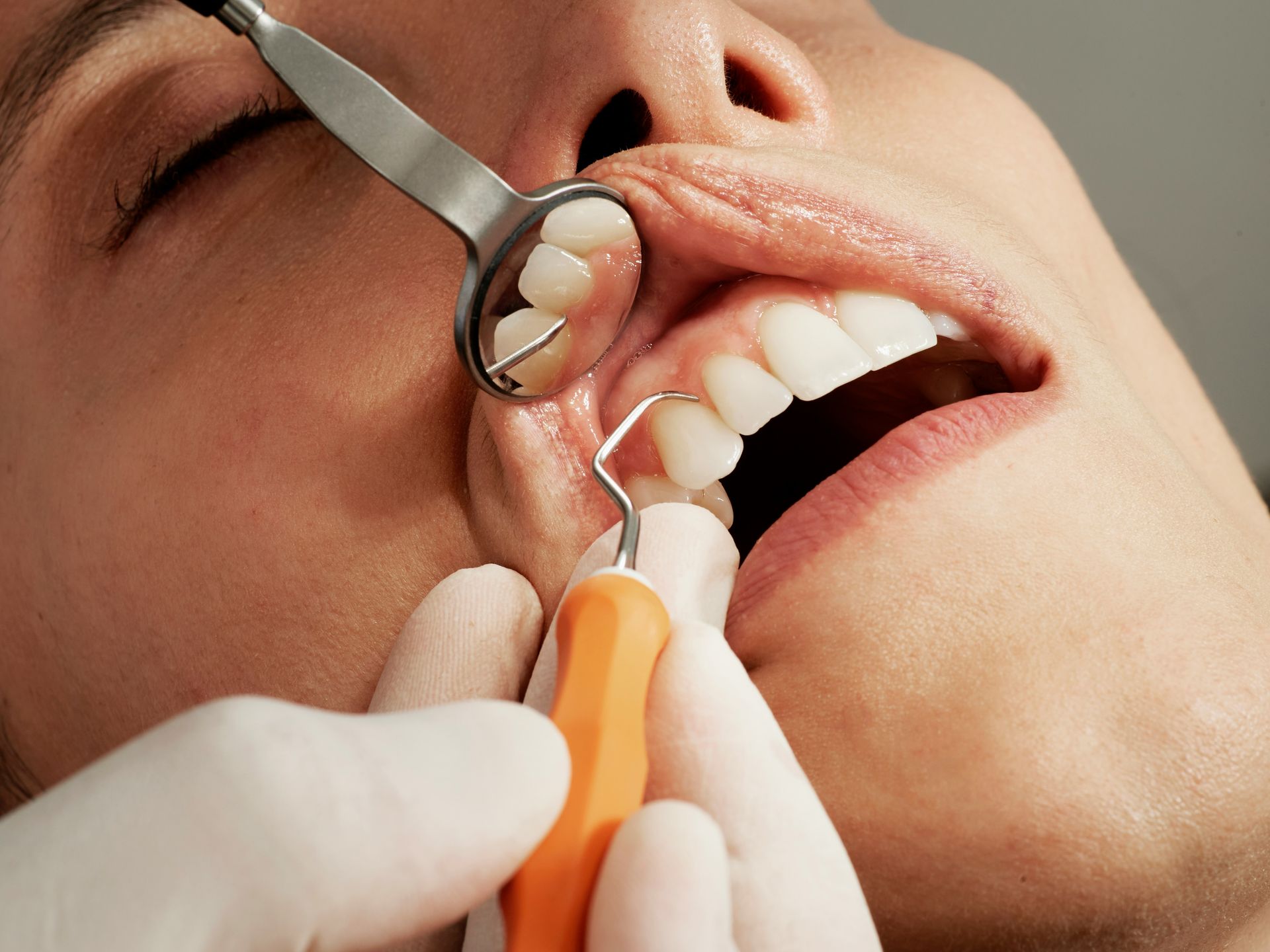 Dentist examining a patient’s mouth with a dental mirror and tool