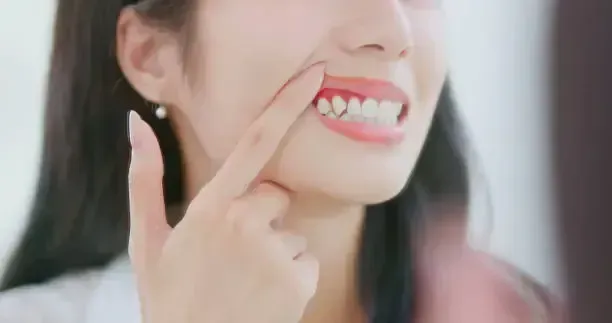 Close-up of a smiling person pointing to a tooth with red gums