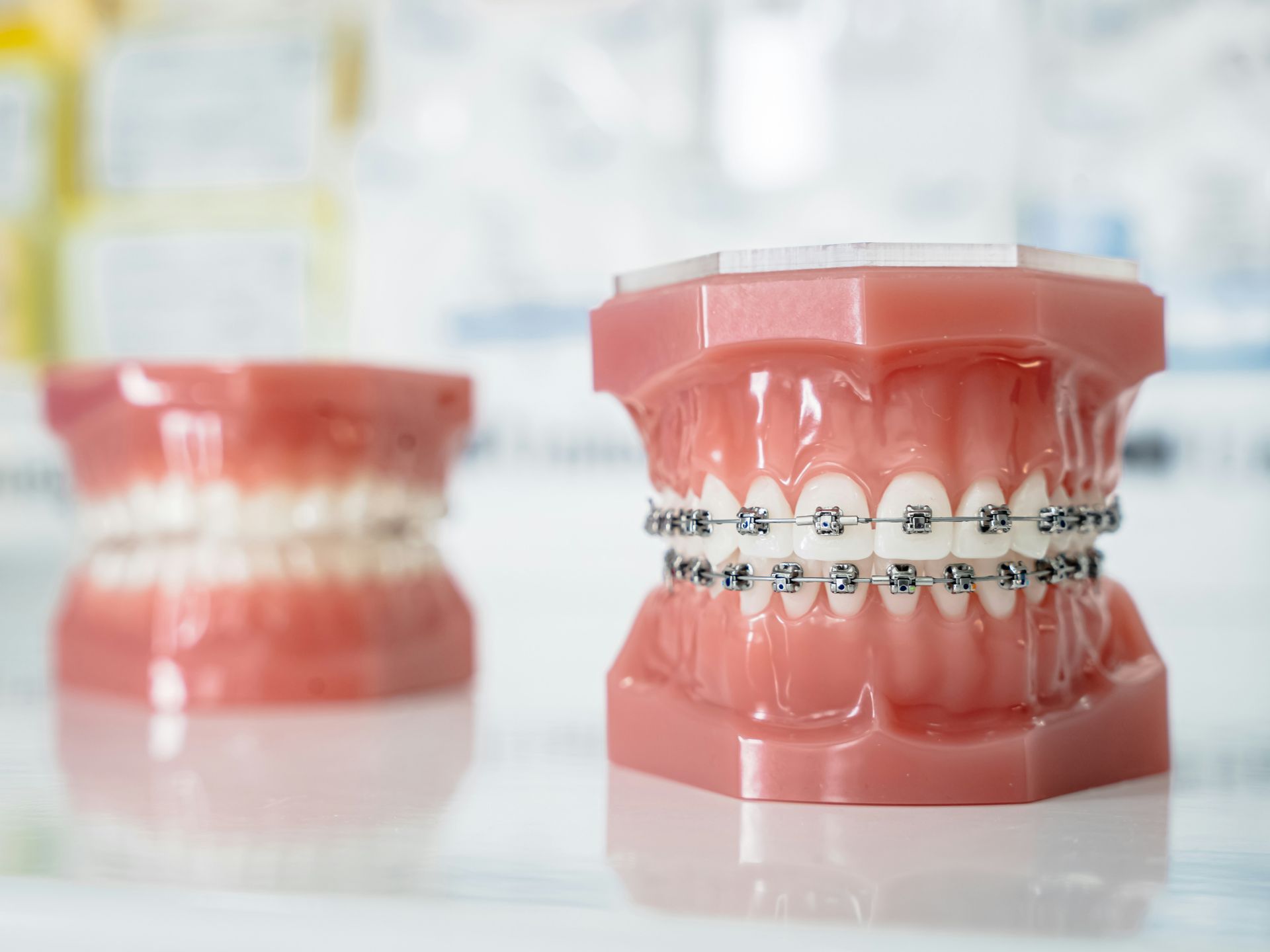 Pink dental models with metal braces, one in sharp focus on a reflective surface