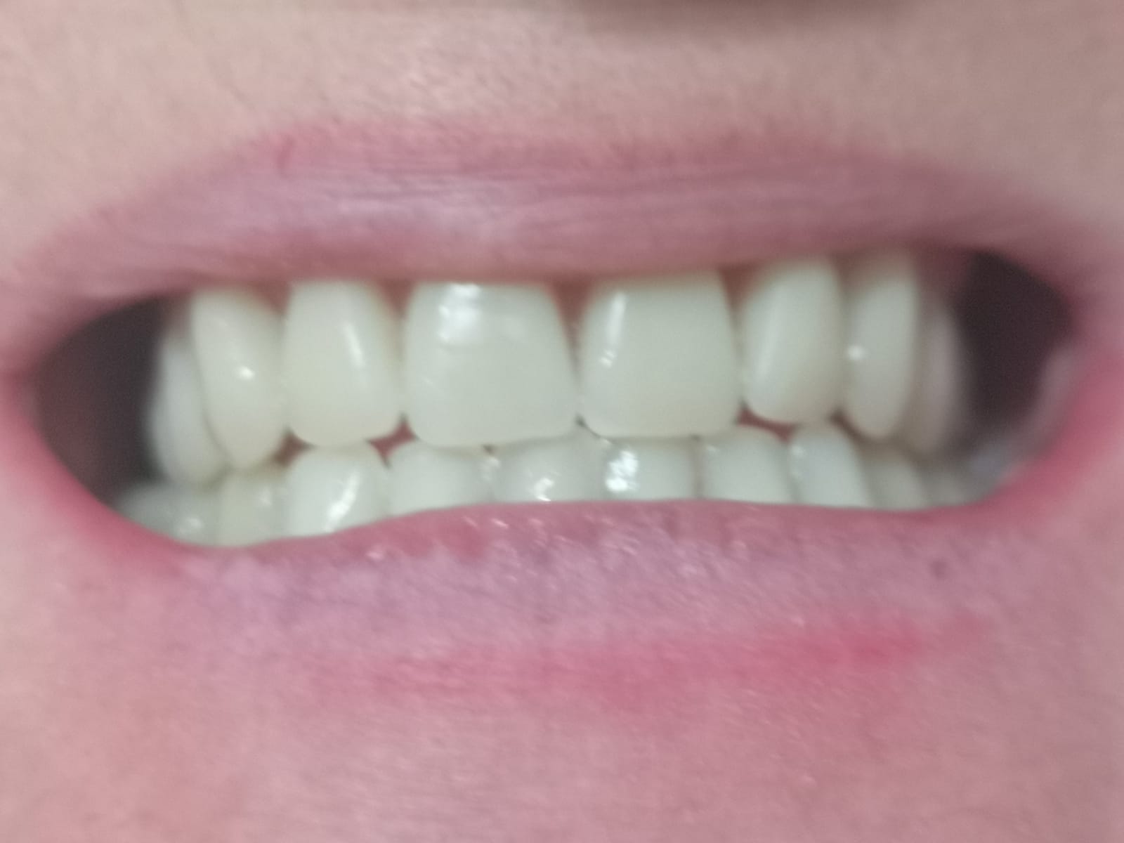 Primo piano dei denti di una persona. Denti bianchi con lievi spazi, visibili in un sorriso naturale.