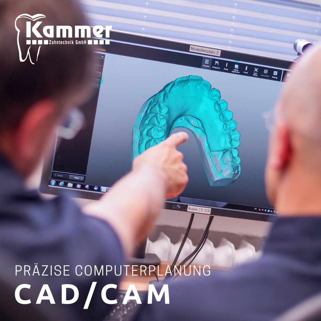 Präzise Computerplanung für den perfekten Zahnersatz!