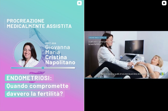 ENDOMETRIOSI TRATTAMENTI