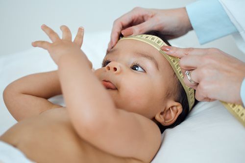 Baby's head being measured by a person with a tape measure, lying on a white surface.