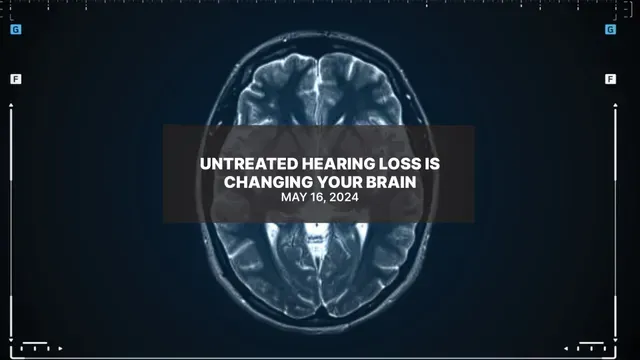 An advertisement for untreated hearing loss is changing your brain