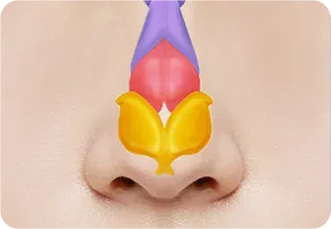 복코성형 과정 - 수술 전