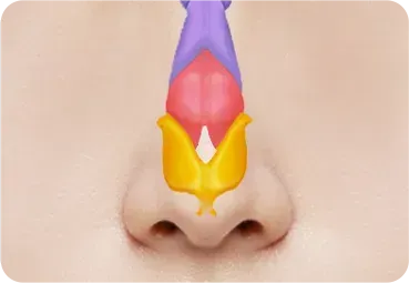 복코성형 과정 - 슬림한 코끝