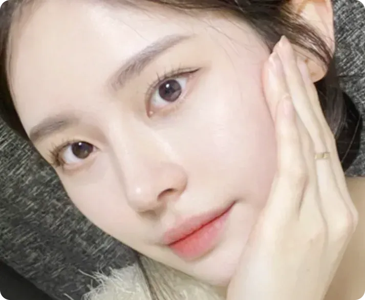 복코성형 상담을 고민하는 분의 모습